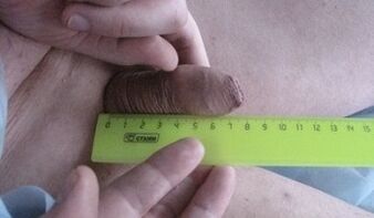 Measuring penis size